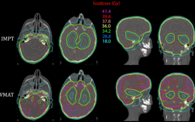 Xstrahl in Action: MRI-based high-precision irradiation treatment planning