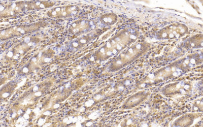 Xstrahl in Action: SARRP Used for Research into Leukocyte Populations After Intestinal Irradiation