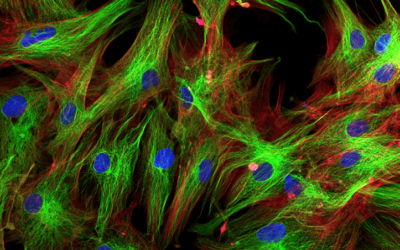 Xstrahl in Action: SARRP used in Mouse Prostate Nestin study