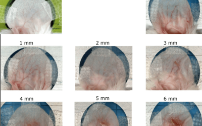 Xstrahl in Action: SARRP Utilized in Pencil Minibeam Radiotherapy Study