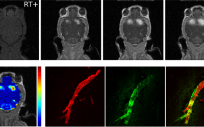 Xstrahl in Action: SARRP Enables Half-Brain Irradiation