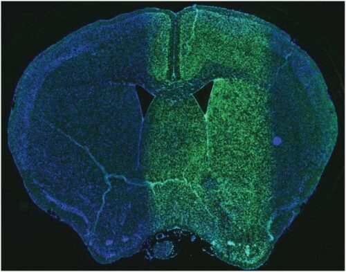 Xstrahl in Action: SARRP Enables Precise and Localized Ablation in Neurogenesis Studies