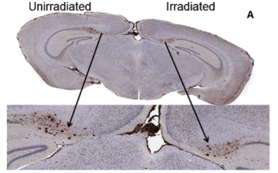 Alzheimers Research on SARRP Leads to Phase 1 Clinical Study