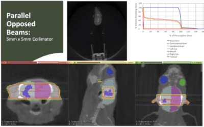 Glioblastoma, Pancreatic and Rectal Cancer Research at University of Glasgow